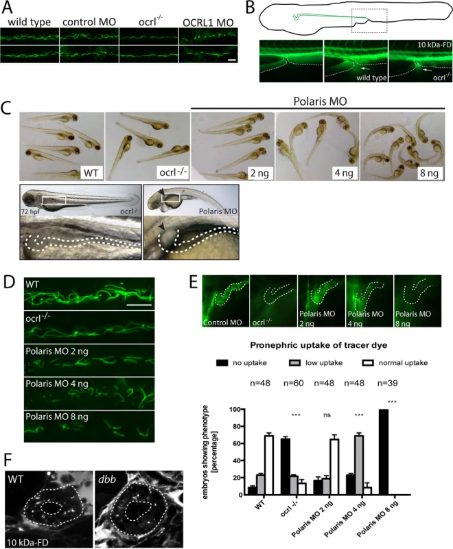 Pronephric cilia in <i>ocrl<sup>-/-</sup></i> zebrafish.
