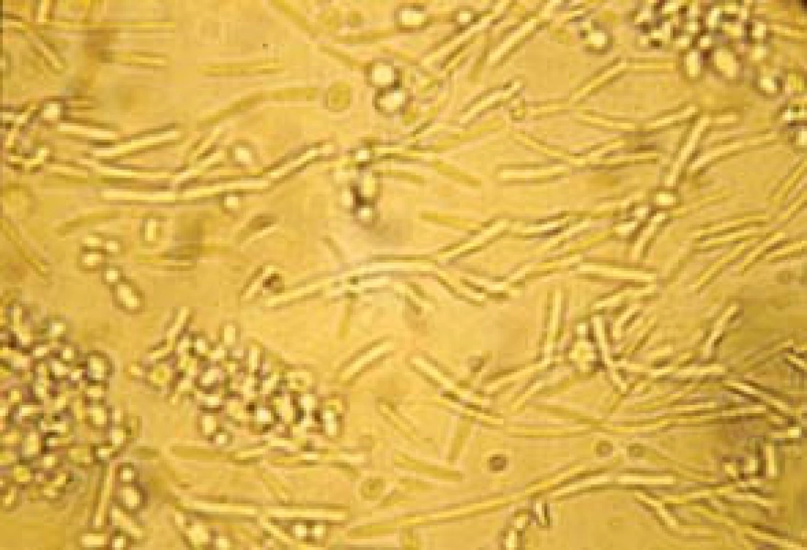 Candida tropicalis.
