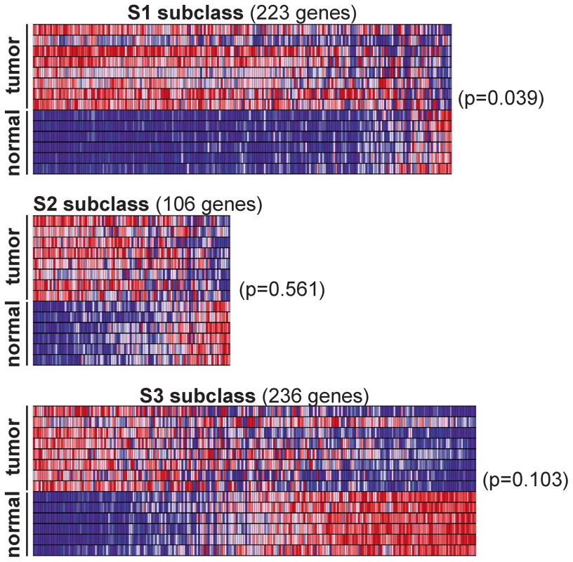 <i>Rtl1</i>-expressing mouse HCCs resemble human S1 subclass.