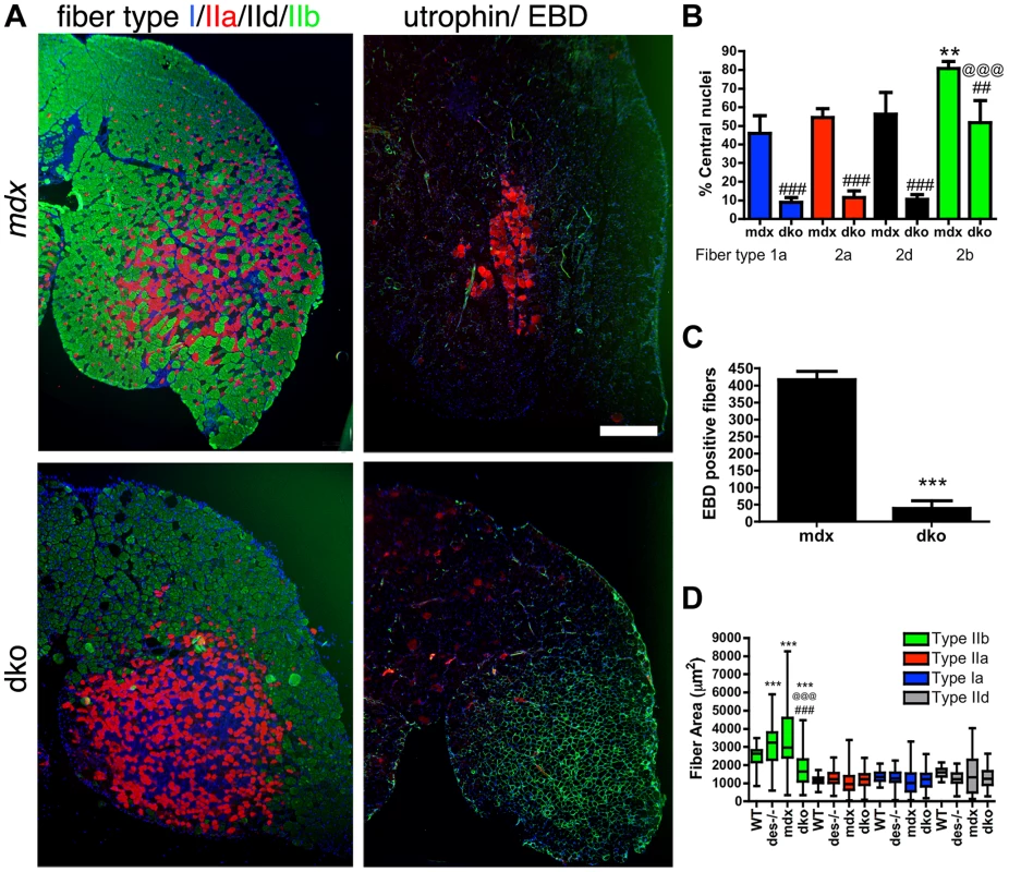 Utrophin maintains the integrity of the dko muscle membrane in a fiber-type specific manner.