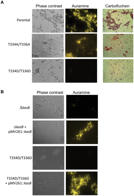 Acid-fast staining of <i>M. tuberculosis kasB</i> isogenic mutant strains.