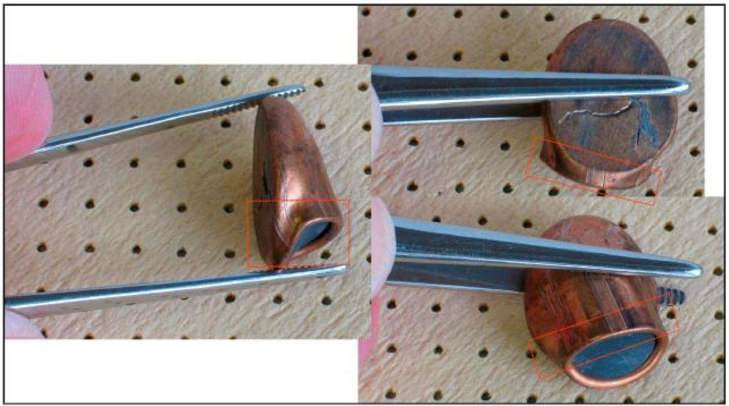 Celoplášťová, střela .45 ACP, zdeformovaná 