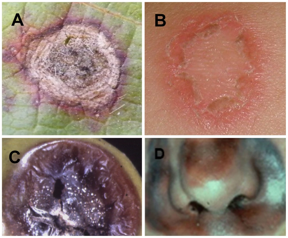 Similar symptoms caused by fungal pathogens on plants and humans.