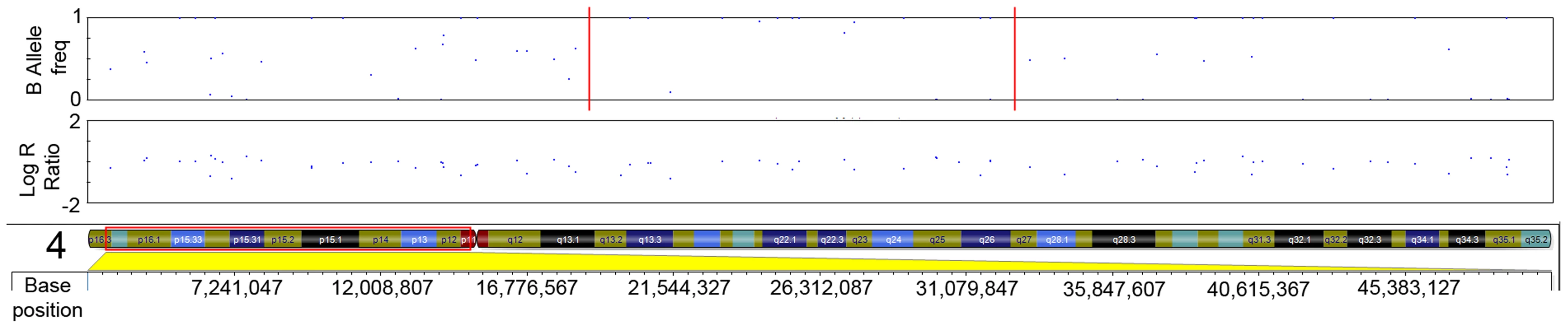 LRR and BAF plot of region of CN-LOH within serrated adenomas.
