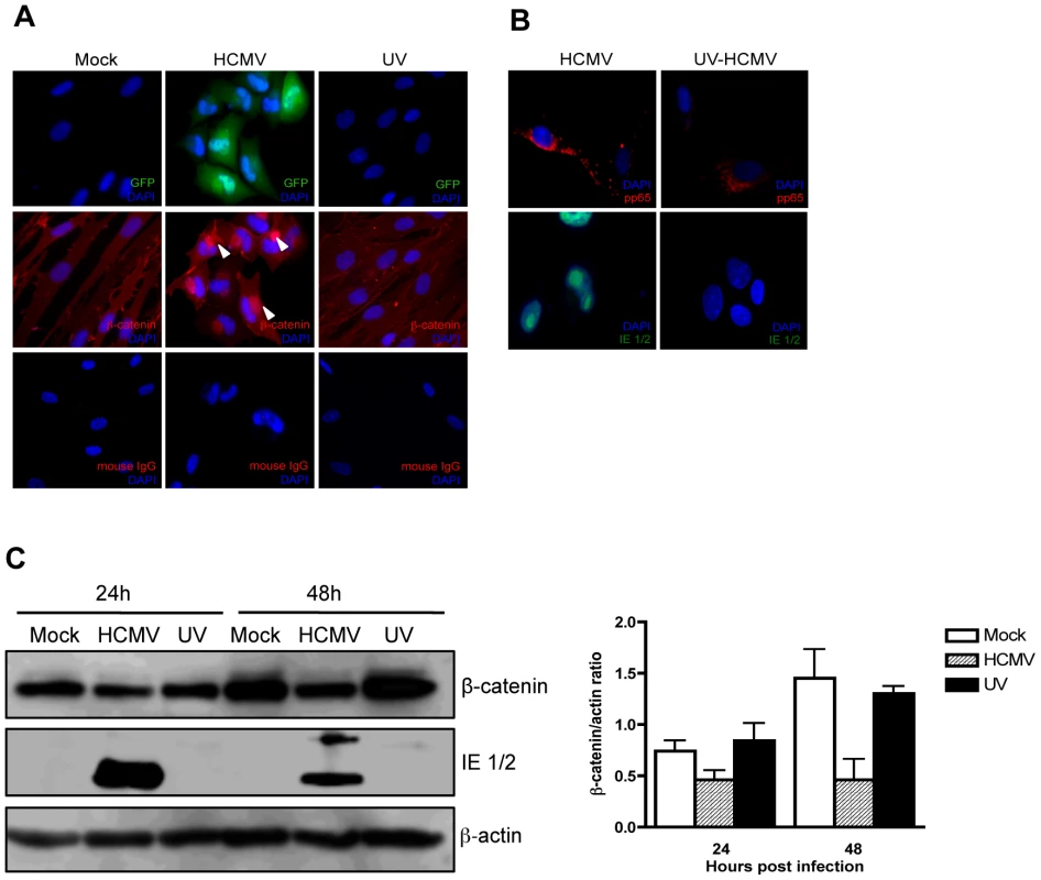 Effect of UV-inactivated HCMV on β-catenin degradation.