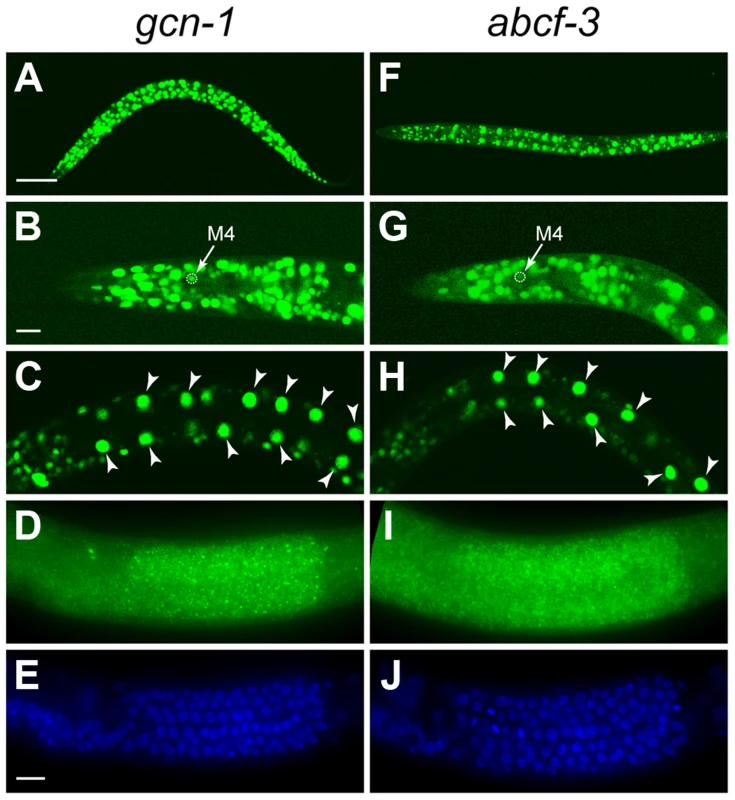 <i>gcn-1</i> and <i>abcf-3</i> are ubiquitously expressed.