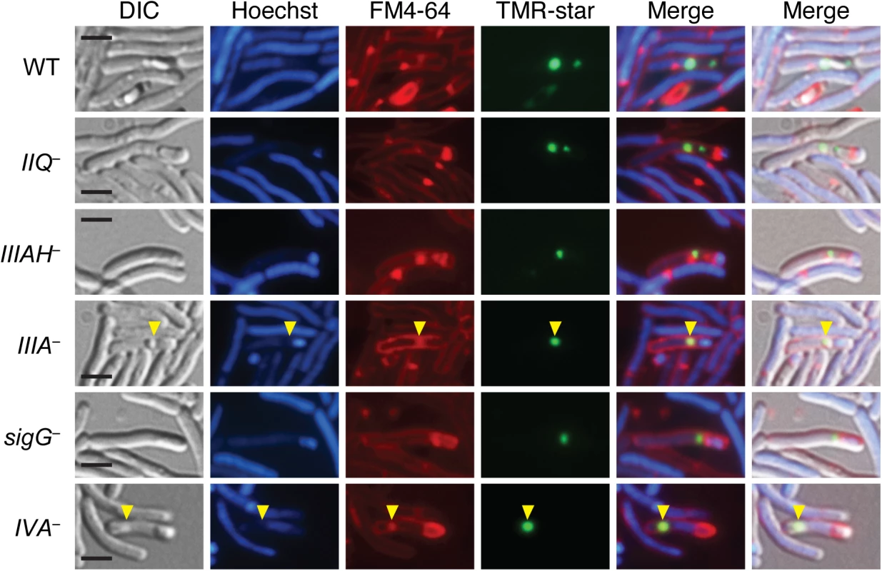 Coat mislocalization in the absence of SpoIIQ and SpoIIIA proteins.