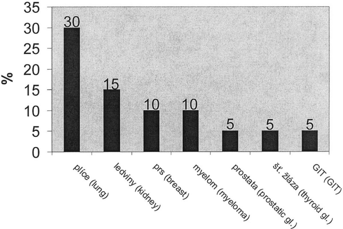Frekvence výskytu páteřních metastáz podle primárního zdroje
Tab. 1. The frequency of occurrence of vertebral metastasis according of prime source