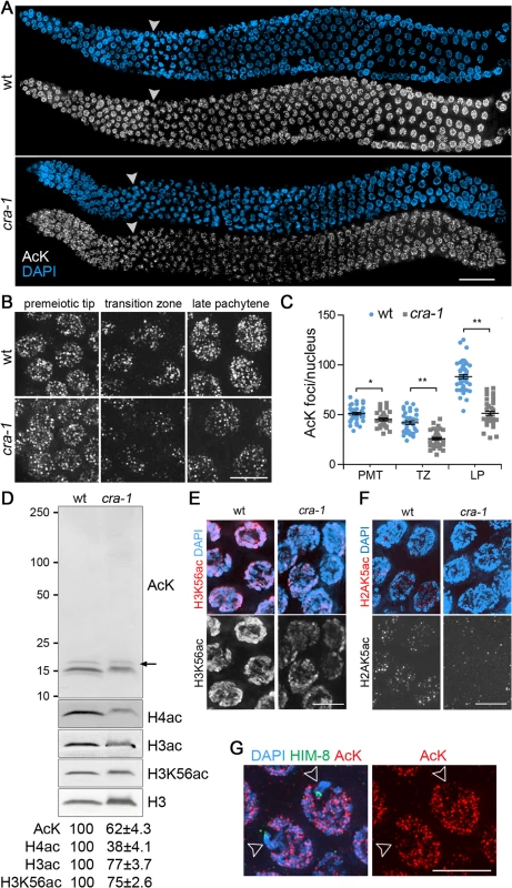 Global histone acetylation is impaired in <i>cra-1</i> mutants.