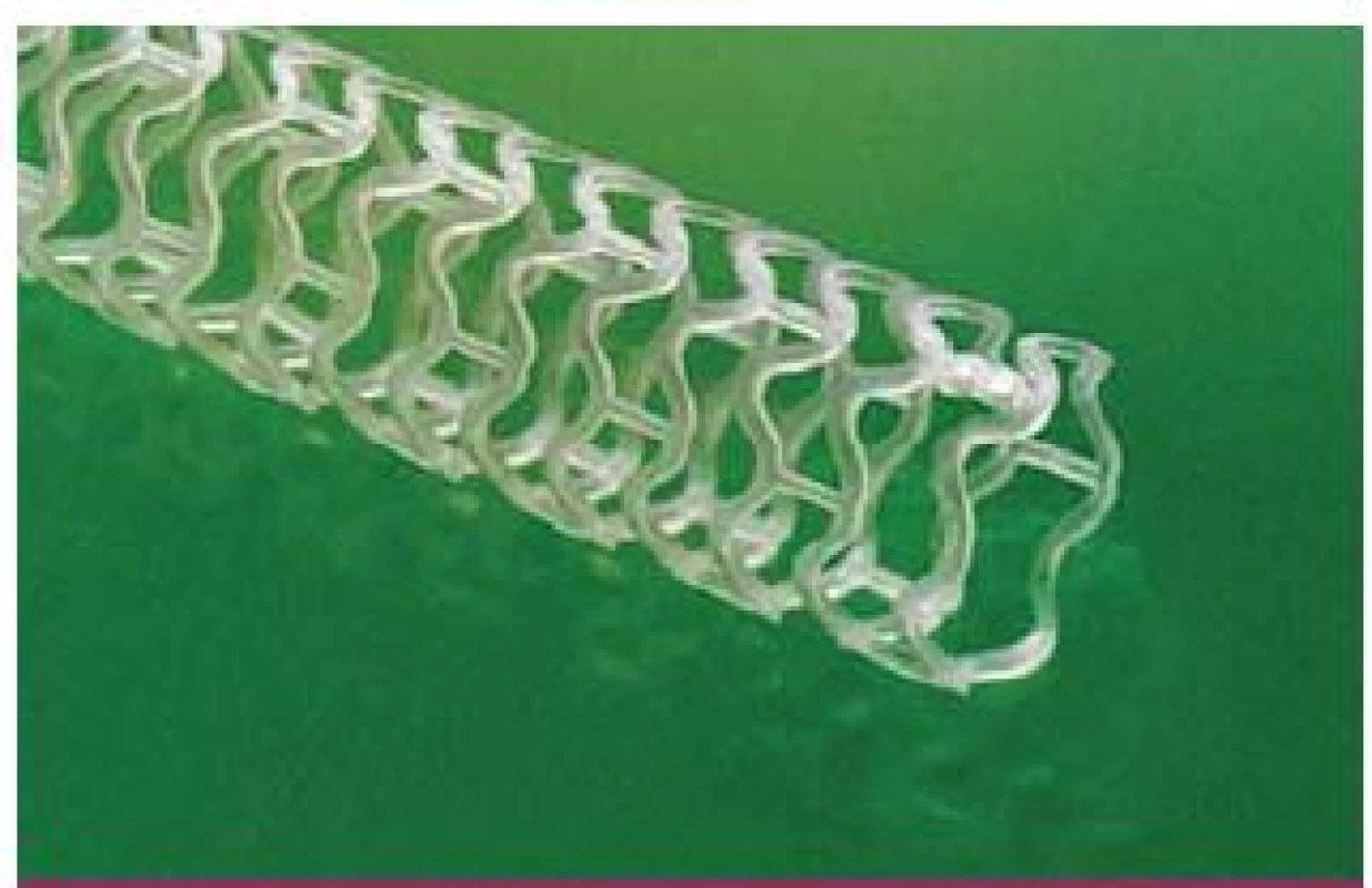 Vstřebatelný stent Absorb BVS (Abbott Vascular, CA, USA), struktura, materiál.