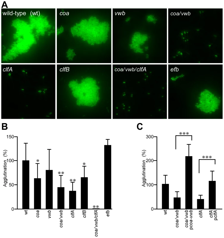 <i>Staphylococcus aureus</i> agglutination in citrate-plasma is a multi-factorial process and essential for the pathogenesis of sepsis in mice.