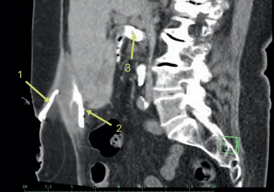 Fig. 3.
