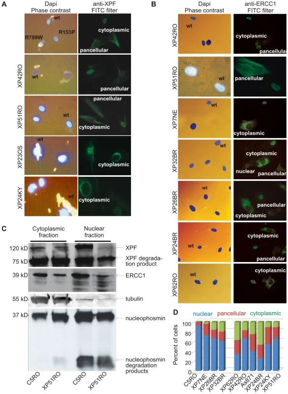 Differential immunofluorescence of cells from patients with <i>XPF</i> mutations.