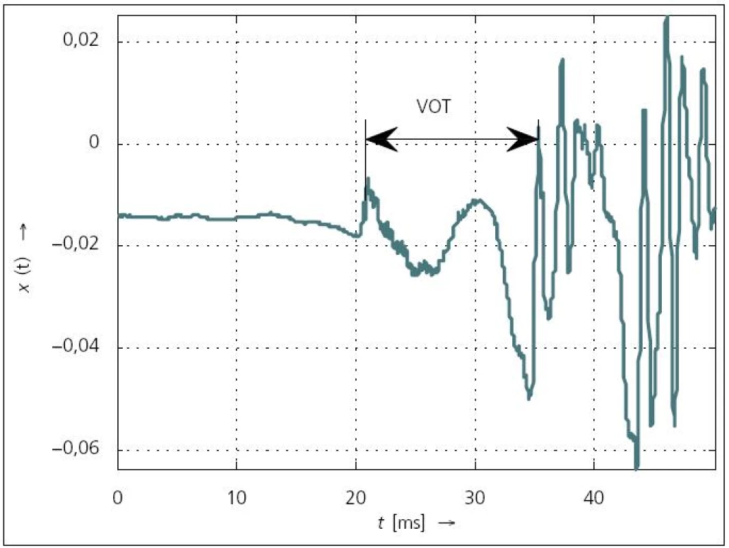 VOT při kombinaci hlásek [p] – [a] (<em>ƒ</em><sub>VZ</sub> = 48 kHz).