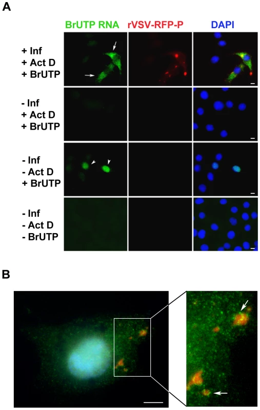 Visualization of viral RNAs in VSV infected cells.