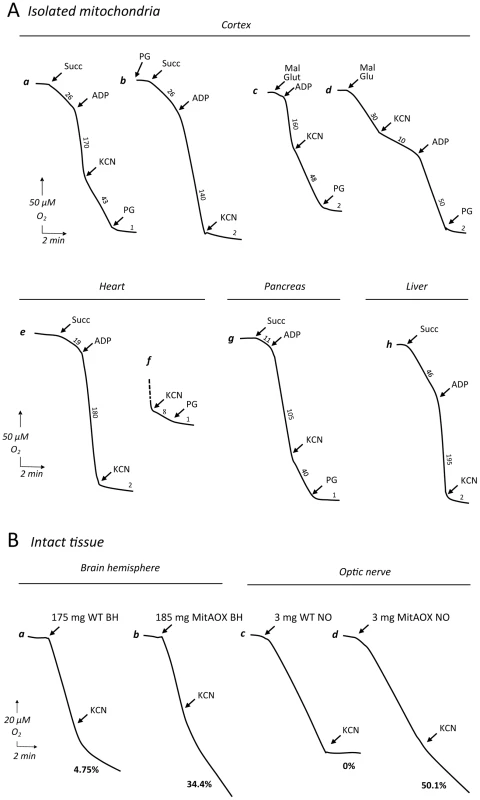Polarographic analysis of oxygen uptake in isolated mitochondria and intact organs.