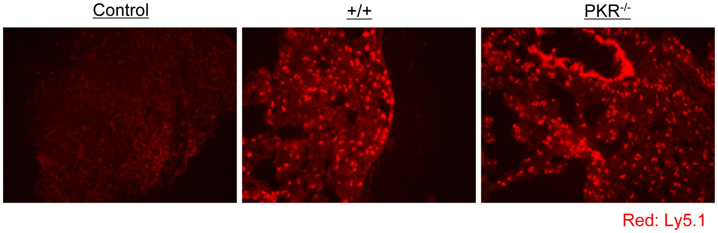 Trafficking of TCR tg P14 CD8<sup>+</sup> T cells into infected lungs in +/+ and PKR<sup>−/−</sup> mice.