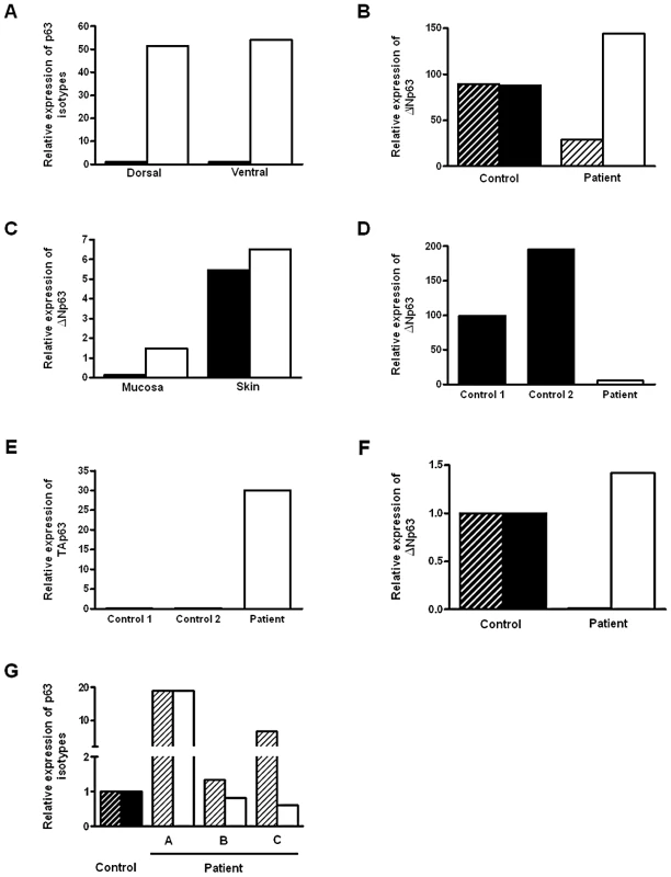 Expression of <i>p63</i> isoforms in BEEC patient tissue and controls.