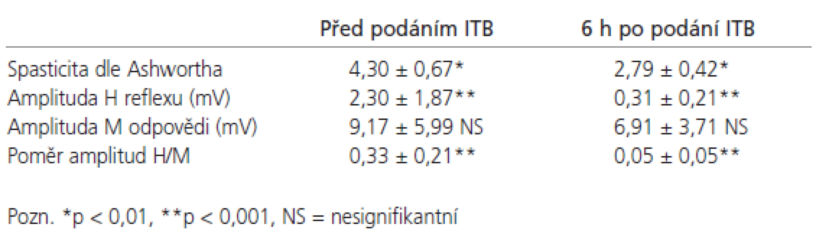 Spasticita dle Ashwortha, amplituda H reflexu, M odpovědi a poměr amplitud H/M u 5 osob po jednorázovém intratékálním podání účinné dávky baklofenu.