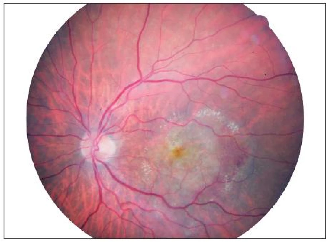 Fundus OS březen 2010