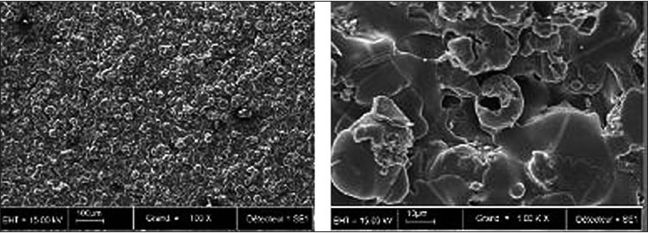 Povrch implantátu s HA naneseným plazmovým nástřikem (Cam Bioceramics -dříve CAM Implants, Nizozemí) – SEM, zvětšení 100x a 1000x, převzato z [43].