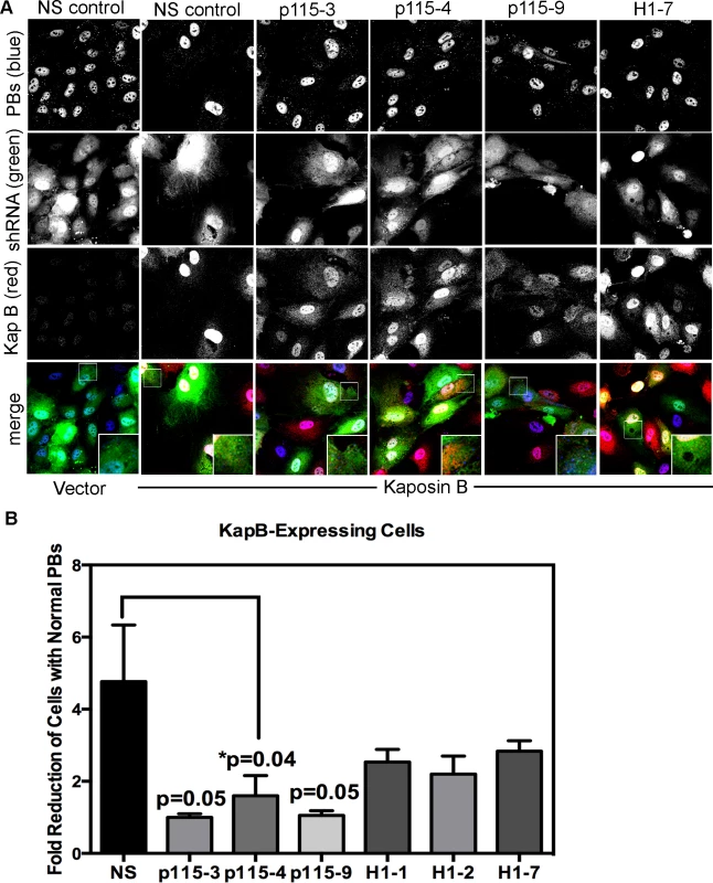 Knockdown of the Rho guanine exchange factor (GEF) p115 prevents KapB-induced modification of p-body dynamics.
