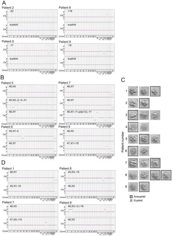 Example results of SNP microarray based 24 chromosome aneuploidy screening in human oocytes and preimplantation embryos that were also characterized for telomere DNA content.
