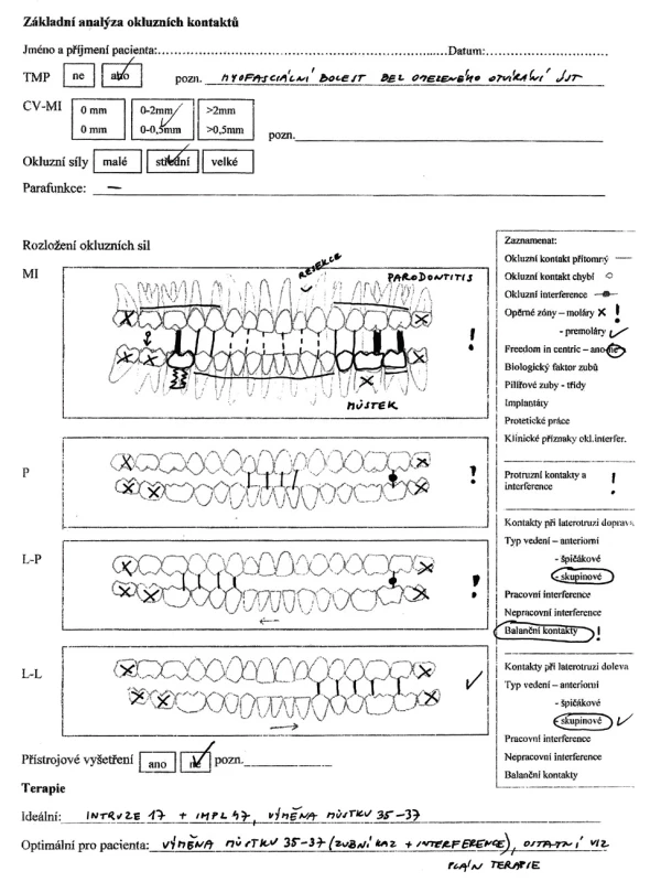 Příklad záznamu vyšetření funkční okluze
TMP – temporomandibulární poruchy, CV – centrální vztah čelistí, MI – maximální interkuspidace, P – protruze, L-P – laterotruze doprava, L-L – laterotruze doleva. Záznam je vhodné doplnit o fotografie a modely.