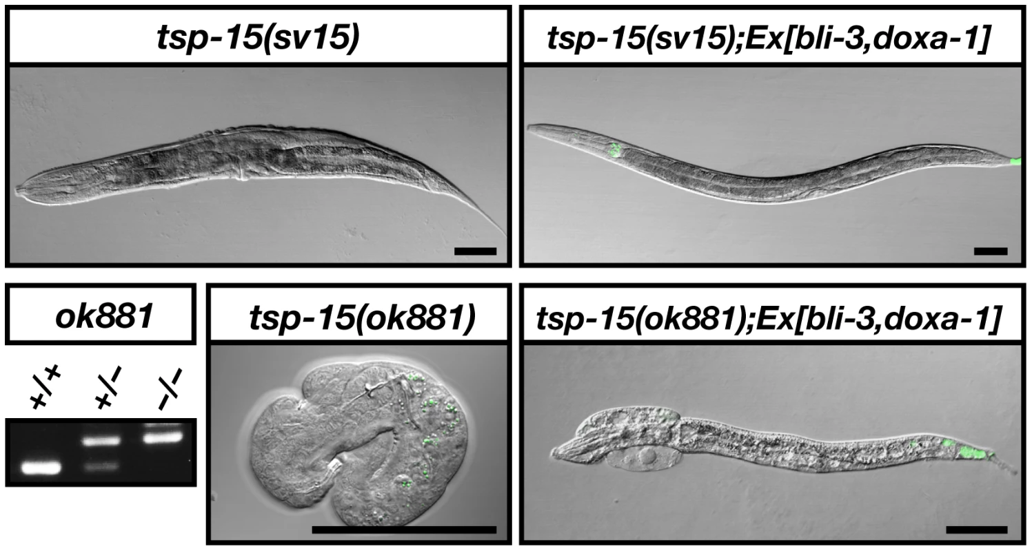 TSP-15 function is compensated with BLI-3 system.