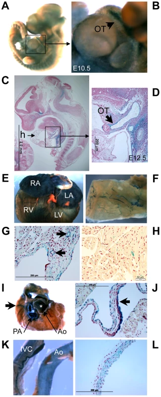 <i>Klf3</i> gene expression detected by LacZ staining in the developing and adult heart and vasculature.