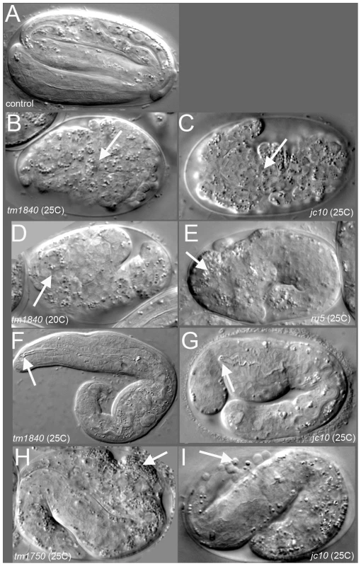 <i>pmr-1</i> mutant embryos show a range of terminal phenotypes at the temperatures tested.