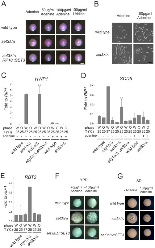 Adenine supplementation suppresses hyperfilamentation of <i>set3</i>Δ/Δ mutants.