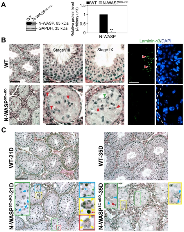 Spermatogenetic arrest and abnormal actin microfilament organization in the seminiferous epithelium of N-WASP<sup>SC-cKO</sup> mouse testes.