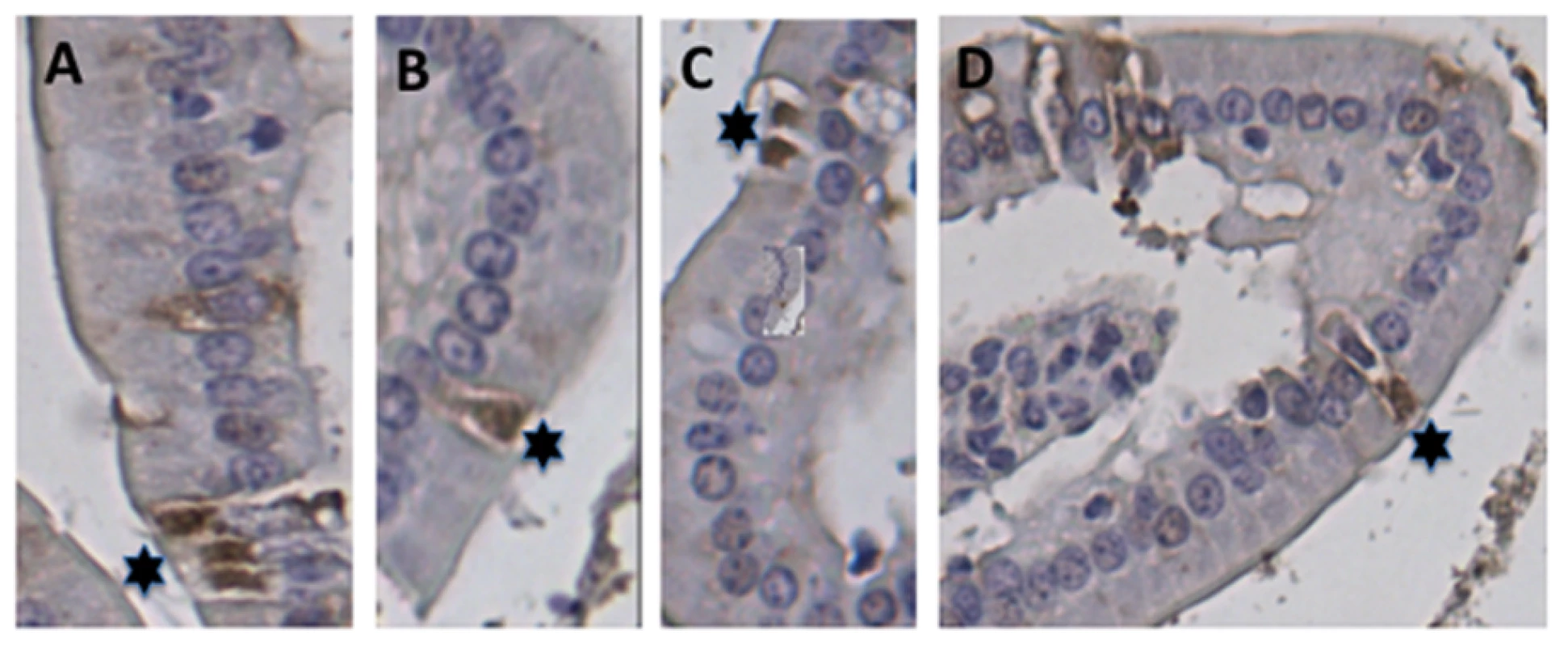 Localization of EC cells in the small intestine of mice.