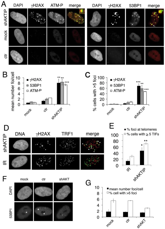 AKTIP downregulation induces TIF formation.