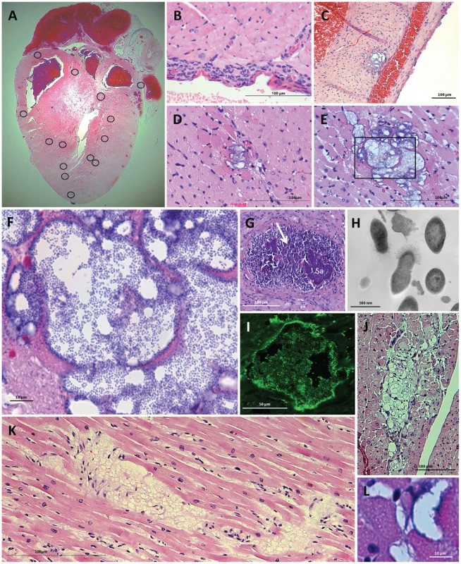 Cardiac lesions form as the result of IPD.