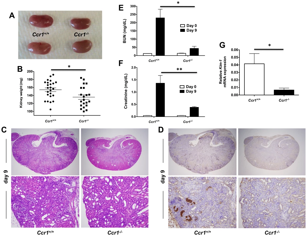Ccr1 deficiency results in decreased kidney tissue damage.