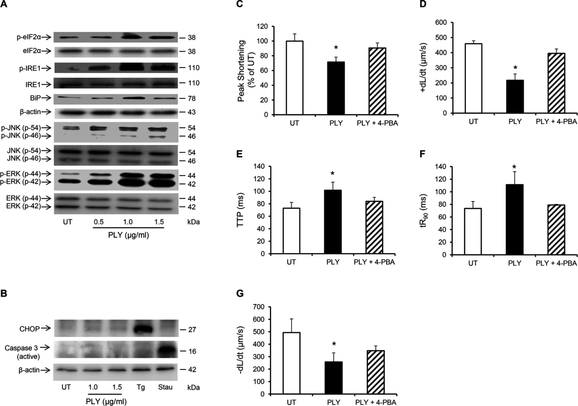 PLY induces endoplasmic reticulum (ER) stress pathway without progressing to apoptosis in HL-1 cardiomyocytes.