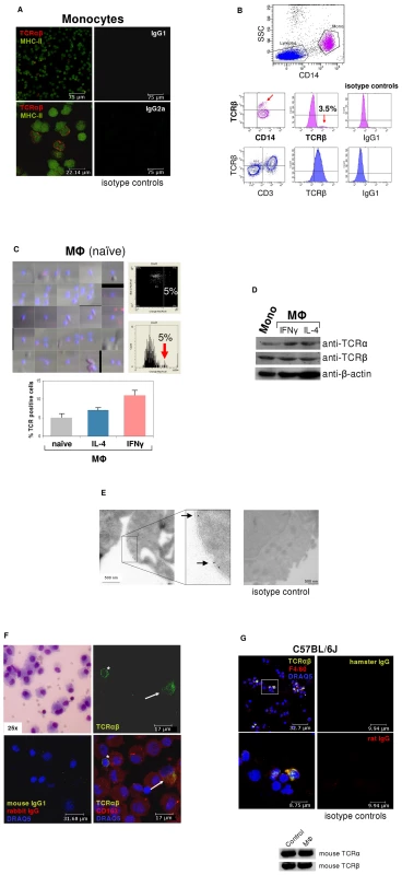 ΤCRαβ expression by subpopulations of human and murine monocytes/macrophages.