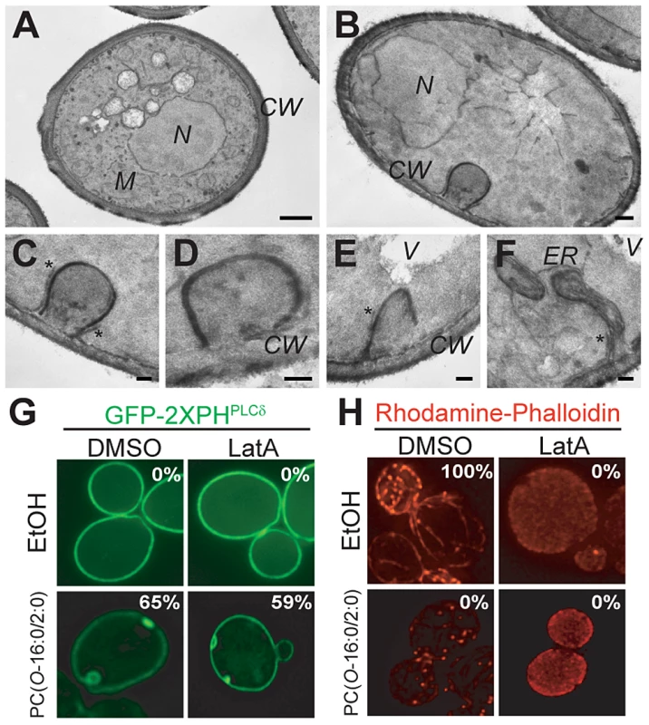 Characterization of PM changes in PC(<i>O</i>-16:0/2:0)-treated cells.