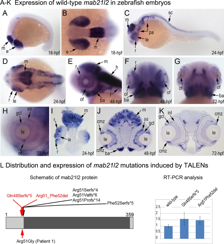 Expression and mutations of zebrafish <i>mab21l2</i>.