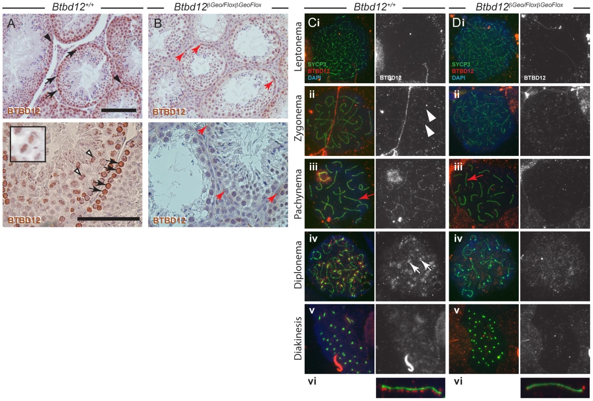 BTBD12 localization in wild type and <i>Btbd12<sup>βGeoFlox/βGeoFlox</sup></i> spermatogenesis.