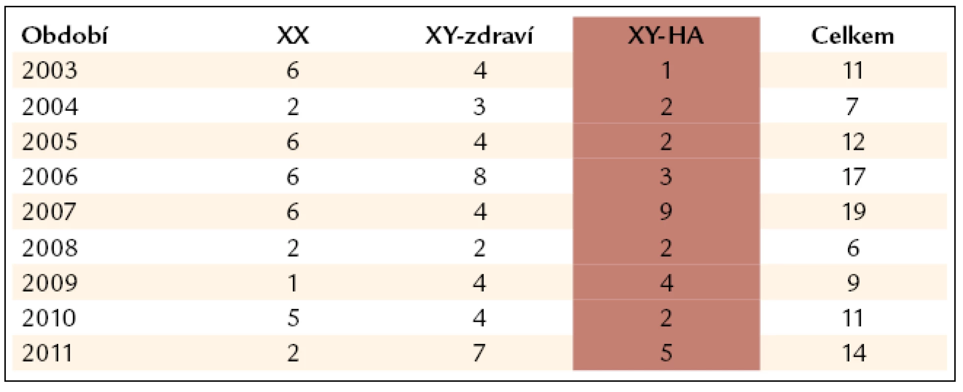 Výsledky prenatálního vyšetření v rodinách s hemofilií A.
