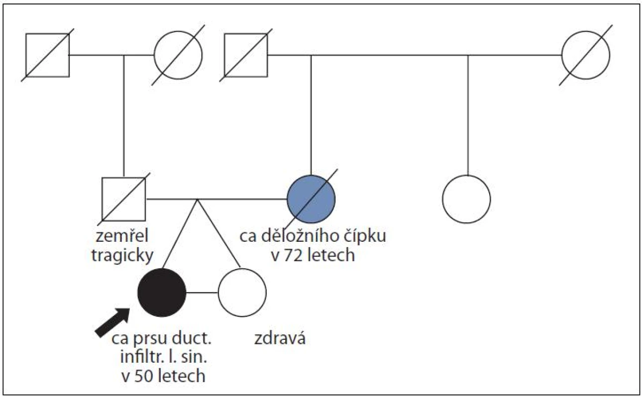 Rodina ženy s duktálním karcinomem prsu v 50 letech a její monozygotní sestry, která nádorem prsu neonemocněla do věku 63 let; časový interval sledování 13 let; molekulárně genetické vyšetření <i>BRCA</i> genů neindikováno, nebyla splněna kritéria pro toto vyšetření.