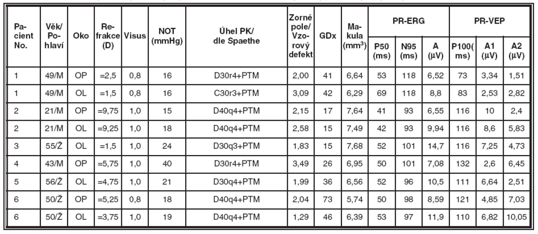 Skupina nemocných s pigmentovým glaukomem (PG), souhrnné výsledky jednotlivých typů vyšetření v této skupině