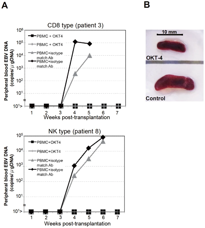 Suppression of the engraftment of EBV-infected T and NK cells by the OKT-4 antibody.