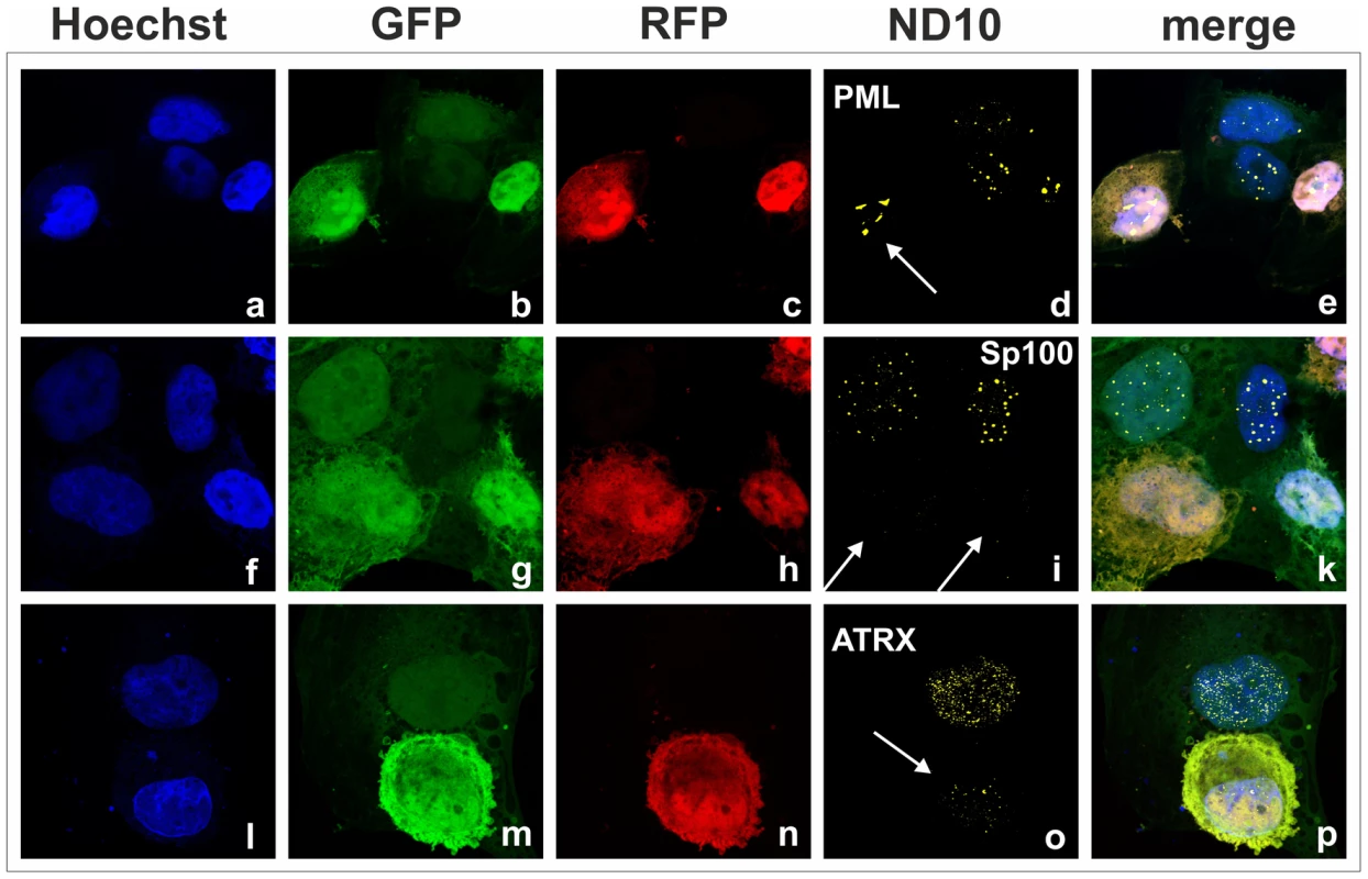 KSHV lytic replication leads to a loss of ATRX and Sp100 expression.