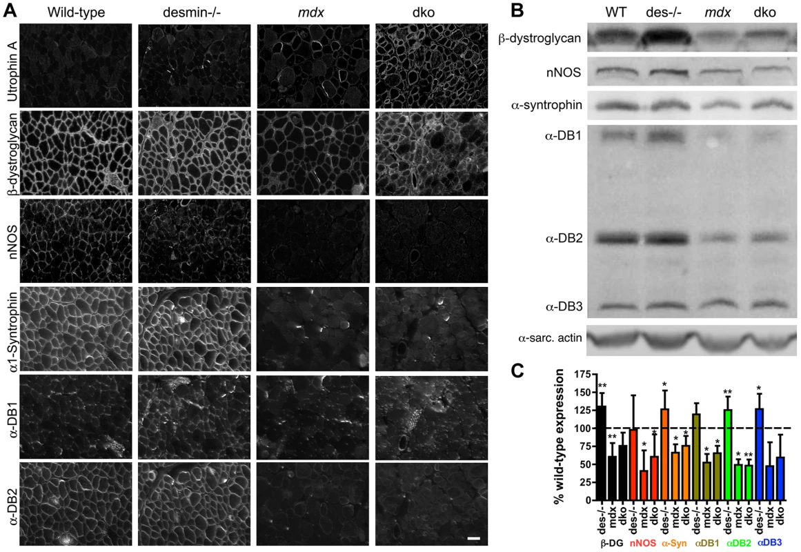 Localization and expression of β-dystroglycan and the NODS complex in skeletal muscles.