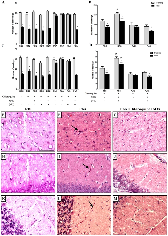 Additive antioxidant treatment prevents cognitive impairment after CM.
