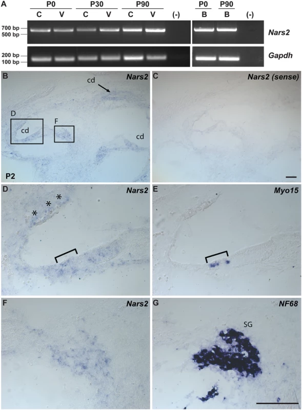 Expression of <i>Nars2</i> in mouse inner ear and brain.